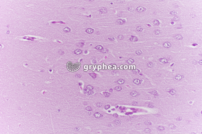 Encéphale CL coupe totale x100 - gryphea.com